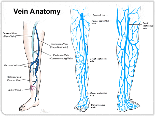 deep vein thrombosis vs varicose veins