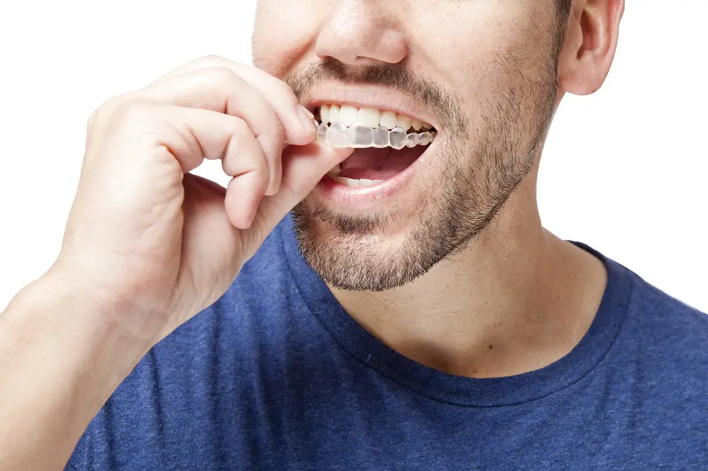 What Is Dental Invisalign