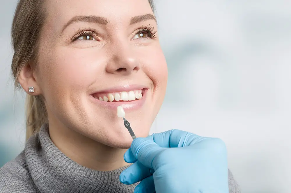 veneers dental treatment