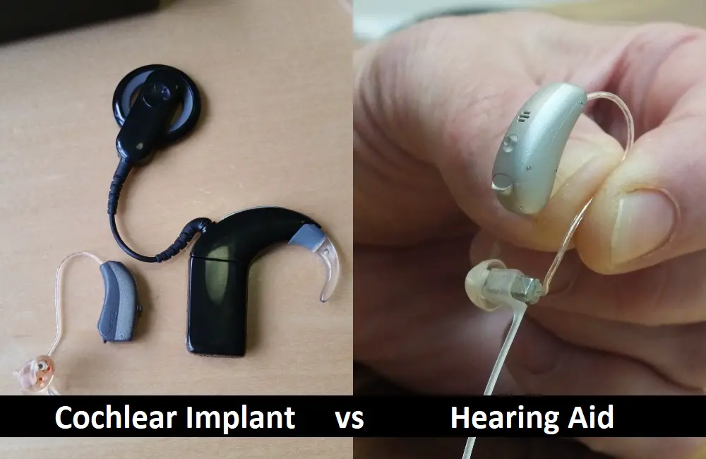 Cochlear Implant vs Hearing Aid